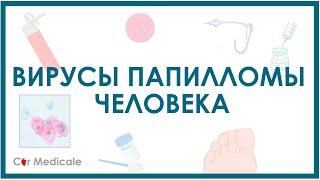 Вирусы папилломы человека - клинические проявления, диагностика, профилактика, лечение