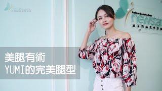 複合式大腿環狀抽脂案例｜享瘦哪都OK｜欣莘時尚美學診所