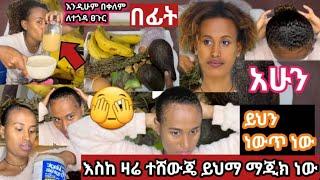 እስከ ዛሬ ተሸውጄ በ2ሳምንት ውስጥ ብቻ እብዲሁም በቀለም ለተጎዳ ፀጉር damaged hair treatment