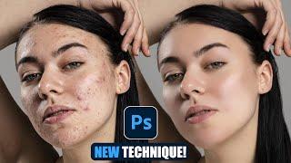 How to Remove Acne - Photoshop Tutorial For Beginners 2024