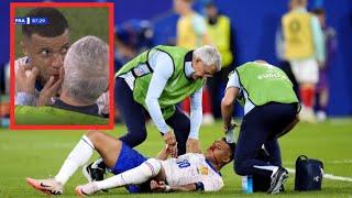 Kylian Mbappe's Nose injury vs Austria