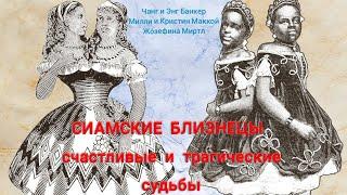 Сиамские близнецы, которые родились и жили в 19 веке. Часть 1.
