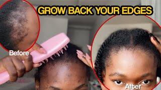 HOW TO GROW BACK EDGES | how to scalp massage for hair growth