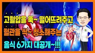 고혈압 낮추는방법 혈압낮추는법 고혈압에좋은음식 식단 6가지