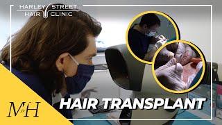 Watching A Hair Transplant At The Harley Street Hair Clinic!