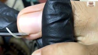 Pedicure tutorial: Both side hook needs to clean and remove hook