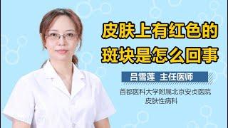 皮肤上有红色的斑块是怎么回事 有来医生