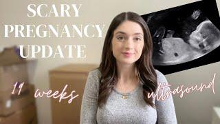 High Risk Doctor Appointment | 19 Week Pregnancy Update | Anti-C Antibodies