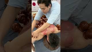 [ASMR]  Cupping Therapy Full body with Giant Cups #asmr #cuppingtherapy #massage #shorts