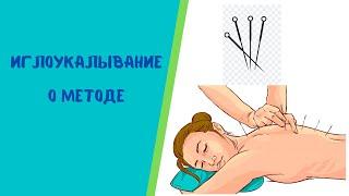 Иглоукалывание,  акупунктура - кратко о методе #Shorts