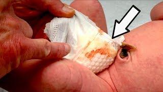 HELP! THERE'S BLOOD IN MY BABIES DIAPER... | Dr. Paul