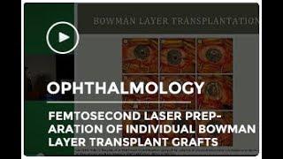 Femtosecond Laser Preparation of Individual Bowman Layer Transplant Grafts