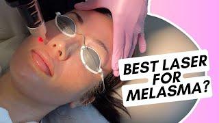 Is Picosure the Best Laser for Melasma?