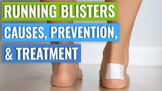 Running Blisters - How To Prevent Blisters Running, What Causes Them, How To Treat Blisters