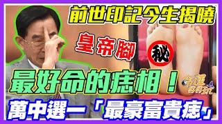 前世胎記富貴痣！黃友輔揭曉萬中選一的好命人！天生皇帝腳的痣相長怎樣？｜每周精選