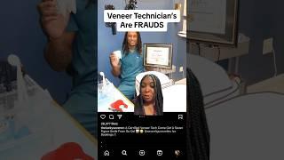 Are Veneer Techs FRAUDS?!