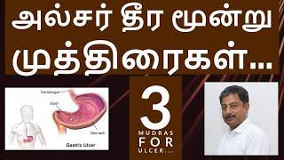 3 Mudras for Ulcer || அல்சர் தீர மூன்று முத்திரைகள் || Mudraguru Pasukkanna