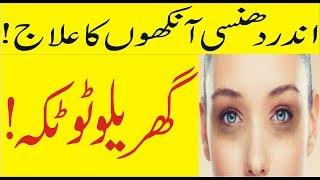 Dhansi Ankhoon Ka Ilaaj in Urdu and Hindi | Beauty Tips | Desi Totika