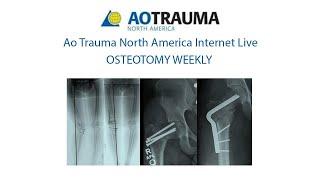 Week 5-S-Quinnan Deformity of Length in the Femur