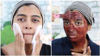 Complete Detox & Deep Cleansing For Acne Prone Skin  || SuperWowStyle