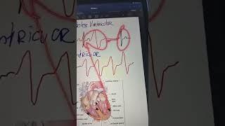 esto es importante si tienes extrasistoles ️🫀 #taquicardia #cardiología #arritmia