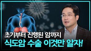 보이지 않는 암세포까지 죽인다?! 수술 전 치료 - 삼성서울병원 폐식도외과 박성용 교수