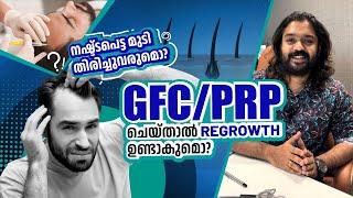 PRP / GFC ചെയ്താൽ പോയ മുടി തിരിച്ചു വരുമോ ? Regrowth ഉണ്ടാവുമോ ?‍️