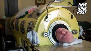‘Polio Paul’ Alexander, who spent 72 years inside iron lung, dead at 78