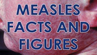 Measles and the MMR Vaccine Facts and Figures