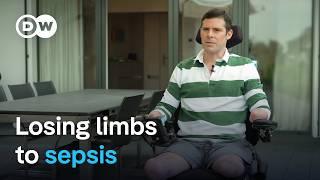 Losing limbs to sepsis | DW Documentary