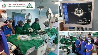 IVUS guided PTCA (Angioplasty) at Life Care Hospital #durgapur #heart #surgeon