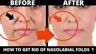 Natural Lift: Face Yoga to Remove Smile Lines & Nasolabial Folds