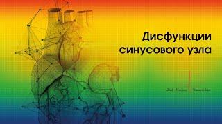 Дисфункции синусового узла