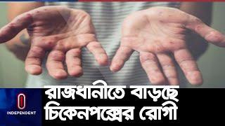 জ্বর, ক্ষুদামন্দা, ক্লান্তি ও শরীরে ব্যথা নিয়ে হাসপাতালে আক্রা-ন্তরা || #Chickenpox Infection