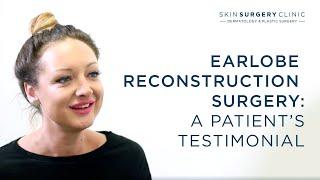 Earlobe Reconstruction Surgery I Patient Testimonial