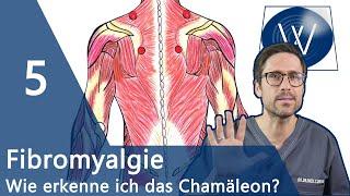 Fibromyalgie: 5 sichere Anzeichen, dass Sie am Fibromyalgie Syndrom (FMS) erkrankt sind!