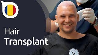 My Experience with Istanbul Vita from Romania | Hair Transplant in Istanbul / Turkey