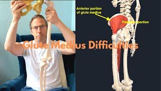 Left Anterior Glute Medius Difficulites During PRI Activities