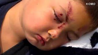 6-year-old badly beaten for standing up to bullies