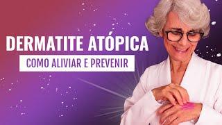 Dermatite Atópica: O que é? Como tratar?