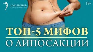 Липосакция: самые распространенные мифы // 18+