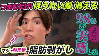 たるんだ顔もほうれい線も今スグ消える『ほうれい線の脂肪はがし』