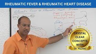 Pathogenesis of Rheumatic Fever | Rheumatic Heart Disease ‍️
