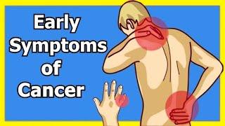 Warning: If you have These Symptoms, it may be The beginning of Cancer without You Knowing!!