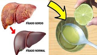 LIMÃO E AZEITE DE OLIVA, LIMPA O FÍGADO, BAIXA O COLESTEROL E TIRA AS DORES NO CORPO