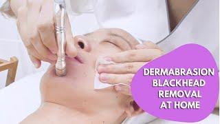 How To Use Diamond Dermabrasion Blackhead Removal Machine At Home | 21P2 myChway