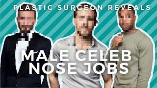 Top MALE Celebrity Nose Jobs