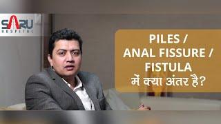 बवासीर, फिशर, भगन्दर में क्या अंतर है? | Difference between Piles, fissure and fistula in Hindi