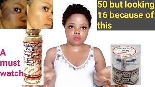 BEST WHITENING FACE CREAM AND HOW TO MIX | Golden face cream honest review | sunburn treatment