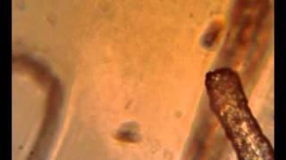 Trichoderma BioSoluciones.mp4